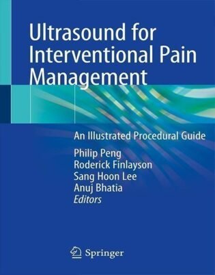 Ultrasound for Interventional Pain Management: An Illustrated Procedural Guide 1st ed. 2020 Edition