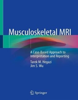Musculoskeletal MRI: A Case-Based Approach to Interpretation and Reporting 1st ed. 2020 Edition